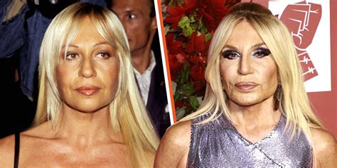 donatella versace before after|current pictures of donatella versace.